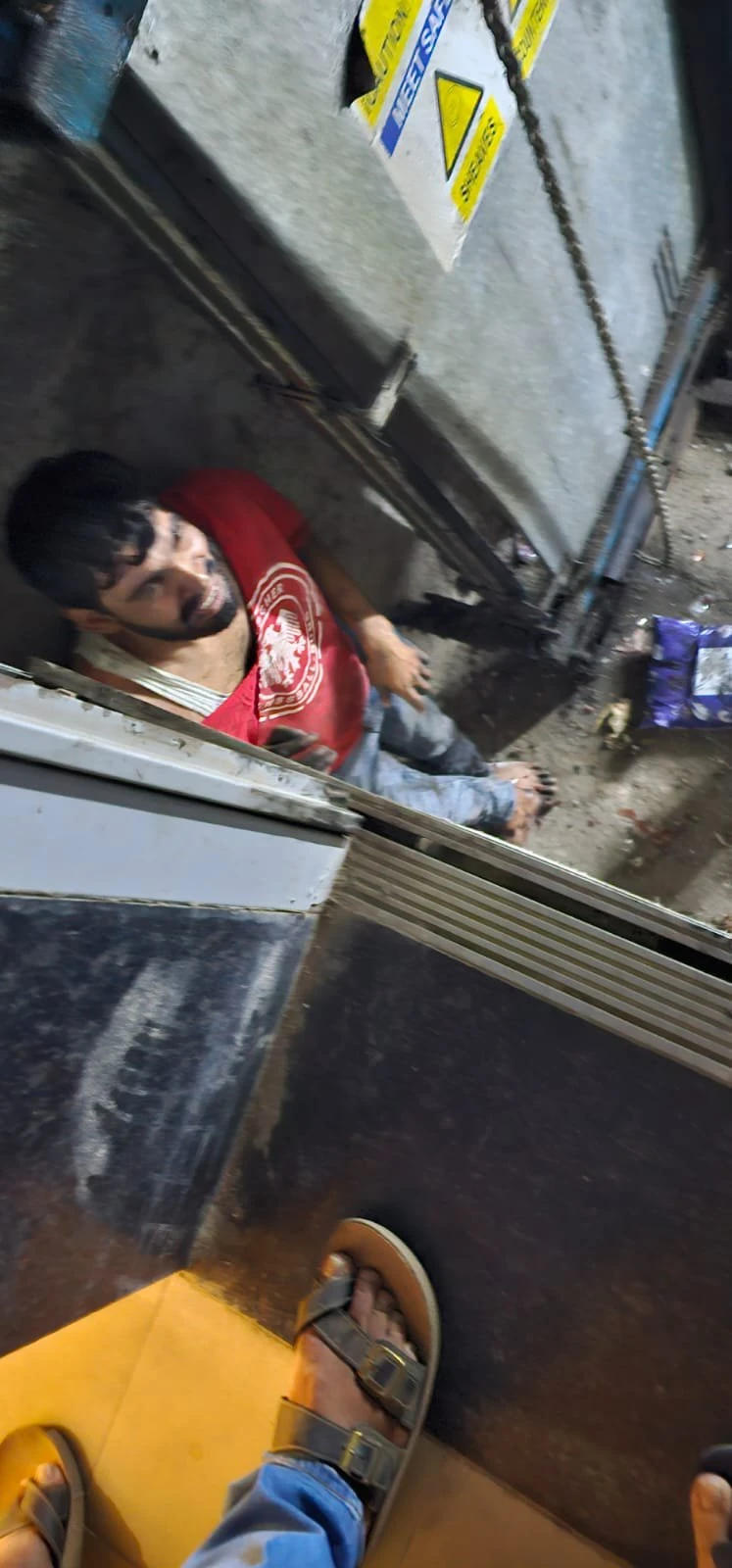 ग्रेटर नोएडा वेस्ट: सोसाइटी की लिफ्ट खराब होने से डिलीवरी बॉय गंभीर घायल, पैर में डाली गई रॉड