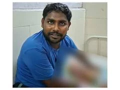 सोनीपत में खतरनाक पिटबुल कुत्ते के हमले से सात महीने का बच्चा घायल, हालत अब स्थिर