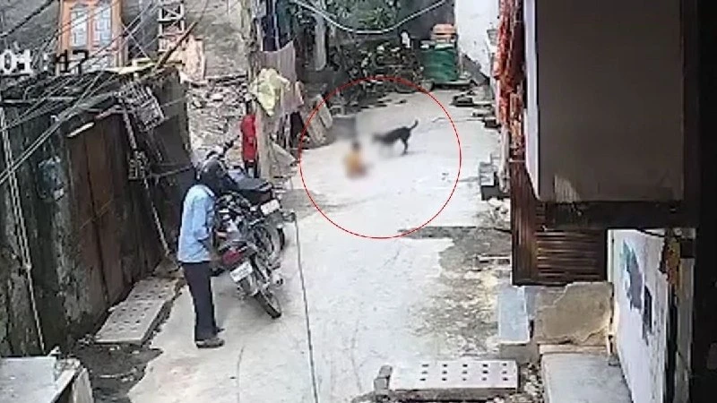 दिल्ली के तिमारपुर में आवारा कुत्ते ने डेढ़ साल के बच्चे पर किया खतरनाक हमला